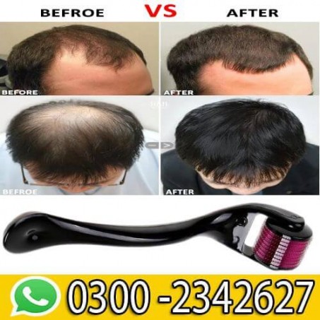 Derma Roller for Hair Regrowth in Pakistan